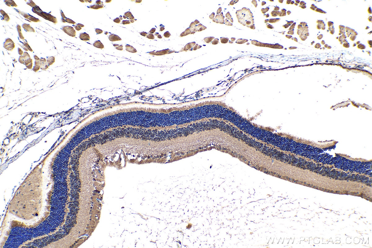 Immunohistochemistry (IHC) staining of mouse eye tissue using MYO3A Polyclonal antibody (28562-1-AP)