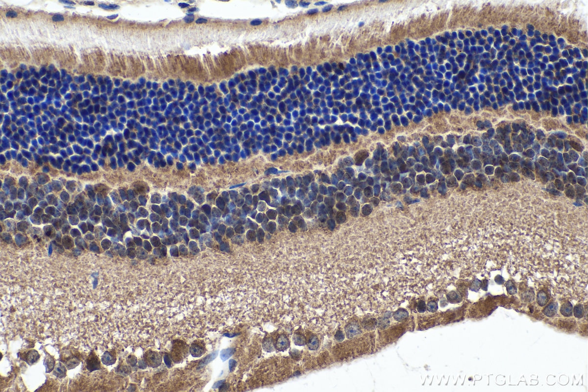 Immunohistochemistry (IHC) staining of mouse eye tissue using MYO3A Polyclonal antibody (28562-1-AP)