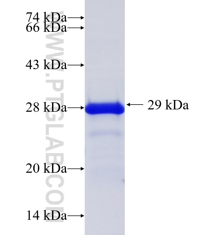 MYO3B fusion protein Ag36195 SDS-PAGE