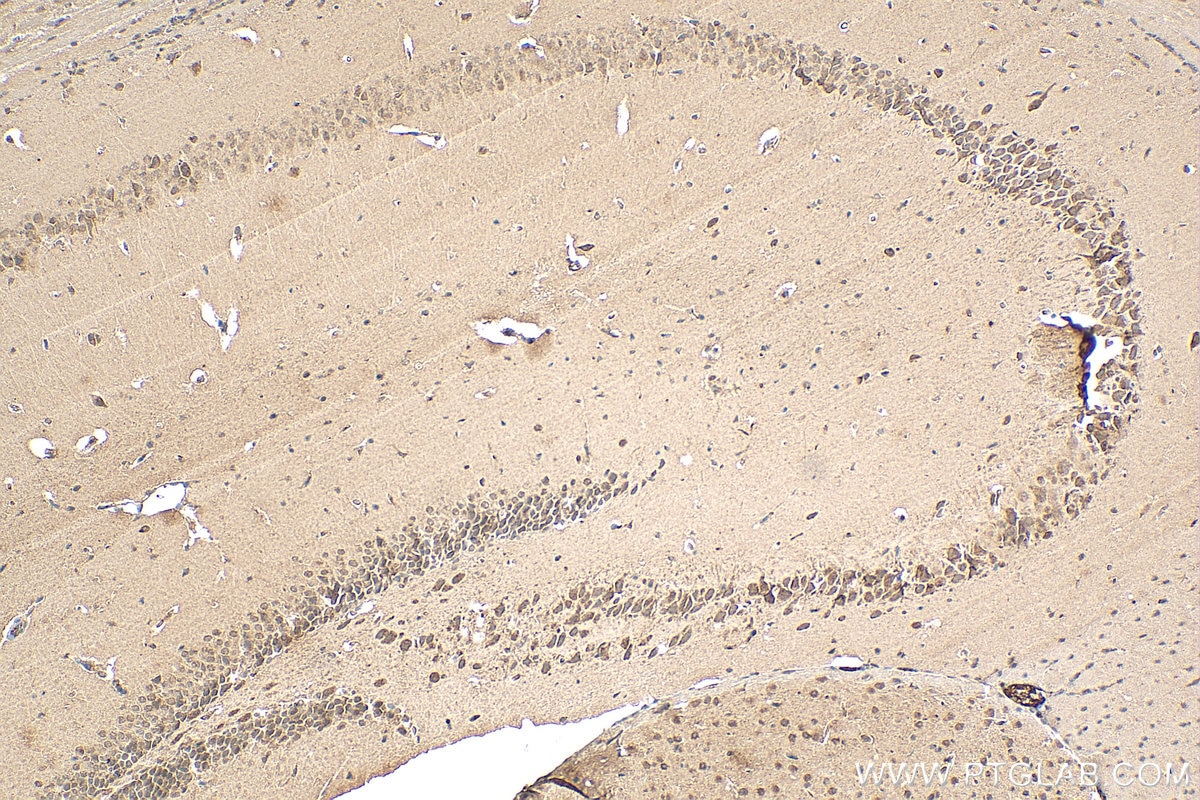 Immunohistochemistry (IHC) staining of mouse brain tissue using MYO5A Polyclonal antibody (55318-1-AP)