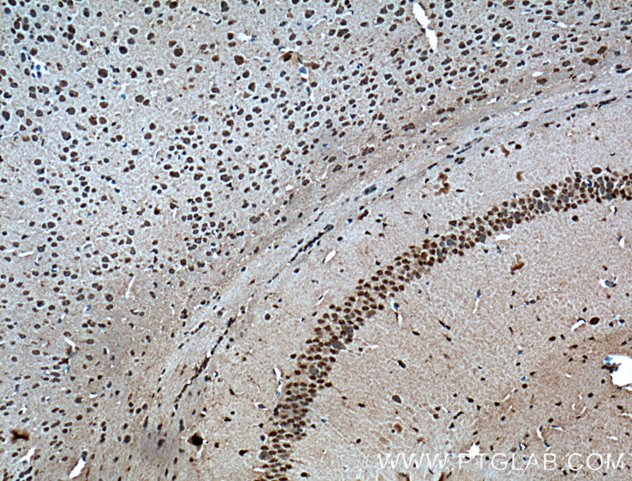 Immunohistochemistry (IHC) staining of mouse brain tissue using MYO5A Polyclonal antibody (55318-1-AP)