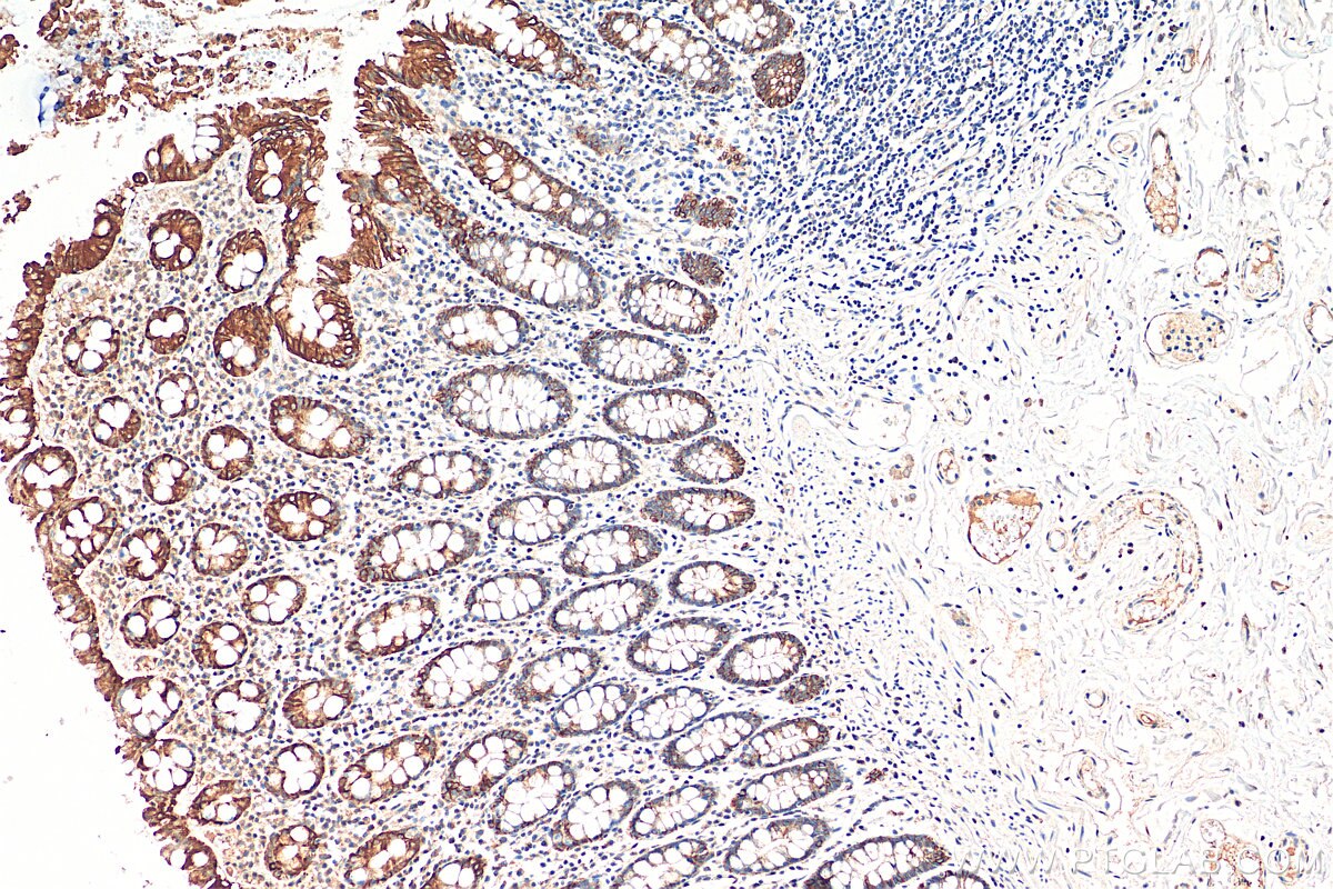 Immunohistochemistry (IHC) staining of human colon tissue using MYO5B Polyclonal antibody (29996-1-AP)