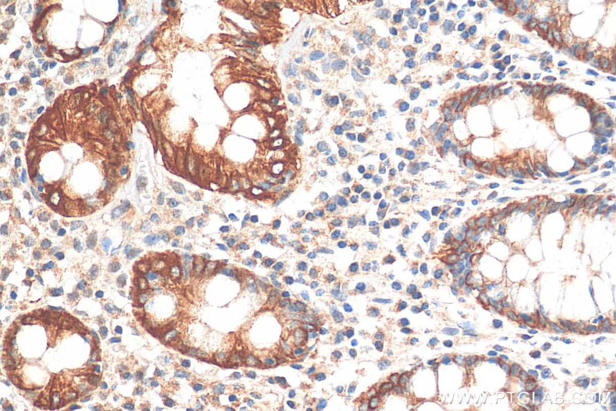 Immunohistochemistry (IHC) staining of human colon tissue using MYO5B Polyclonal antibody (29996-1-AP)