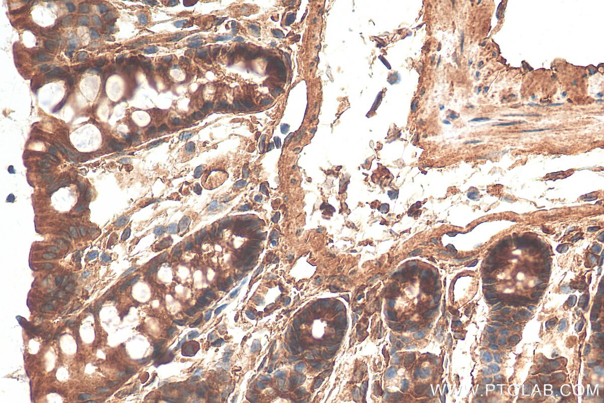 Immunohistochemistry (IHC) staining of mouse colon tissue using MYO5B Polyclonal antibody (29996-1-AP)