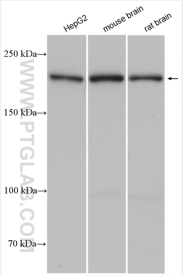 Western Blot (WB) analysis of various lysates using MYO5B Polyclonal antibody (29996-1-AP)
