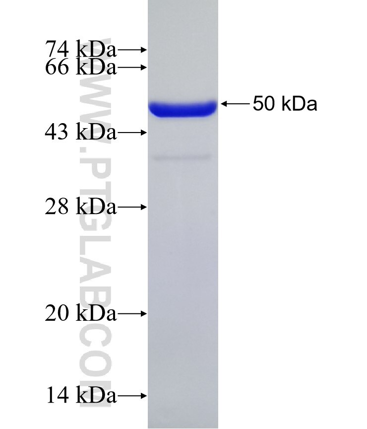 MYO5B fusion protein Ag31590 SDS-PAGE