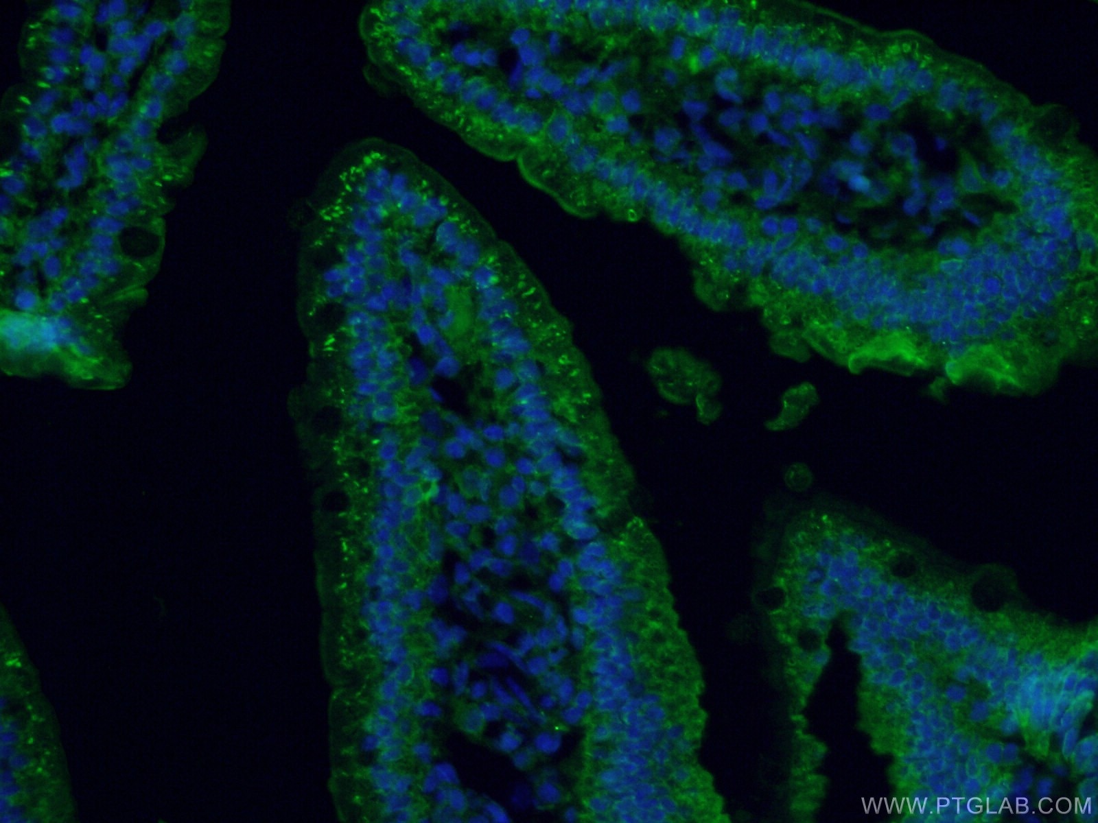 Immunofluorescence (IF) / fluorescent staining of mouse small intestine tissue using MYO6 Polyclonal antibody (26778-1-AP)
