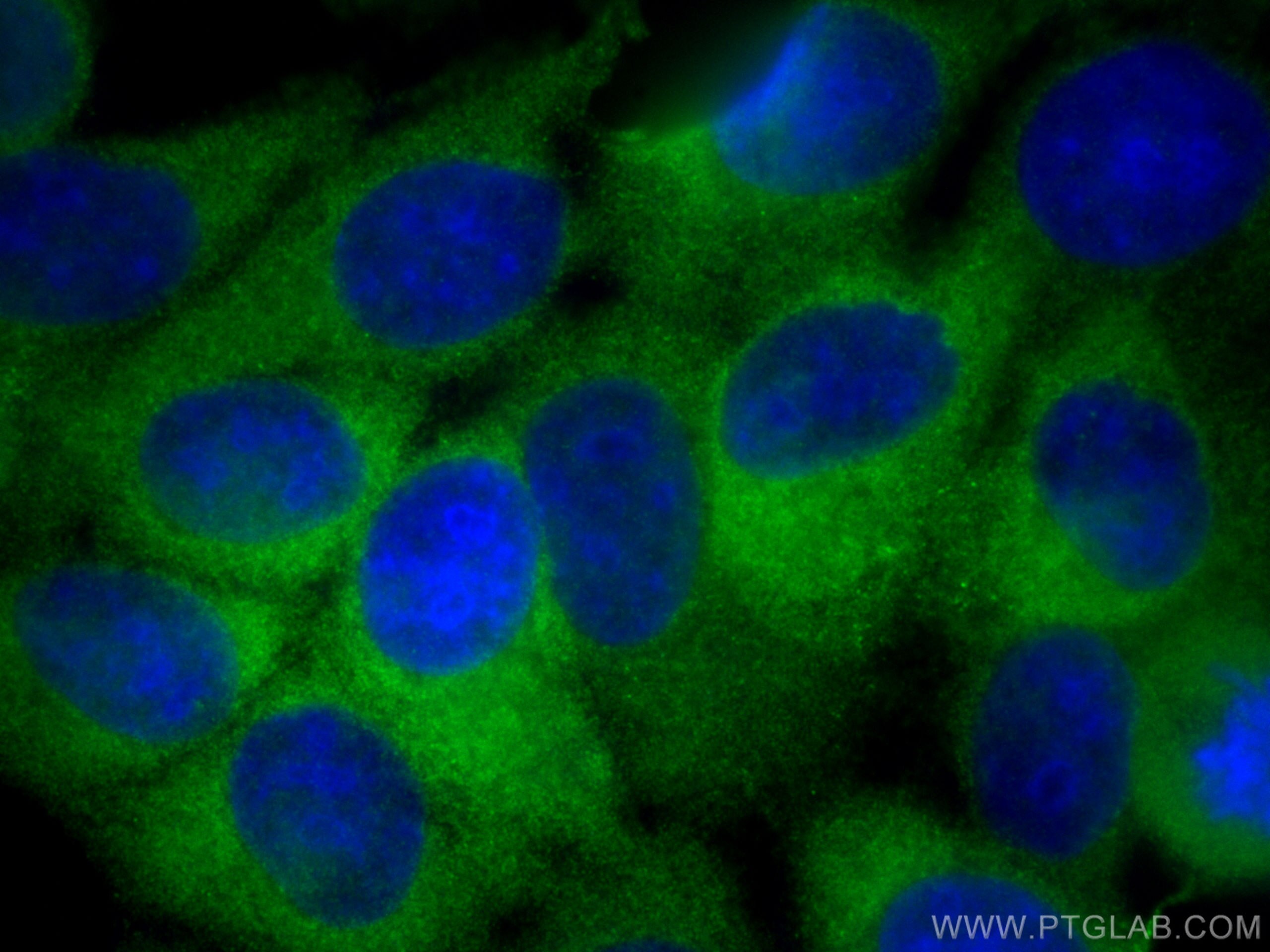 Immunofluorescence (IF) / fluorescent staining of MCF-7 cells using MYO6 Polyclonal antibody (26778-1-AP)