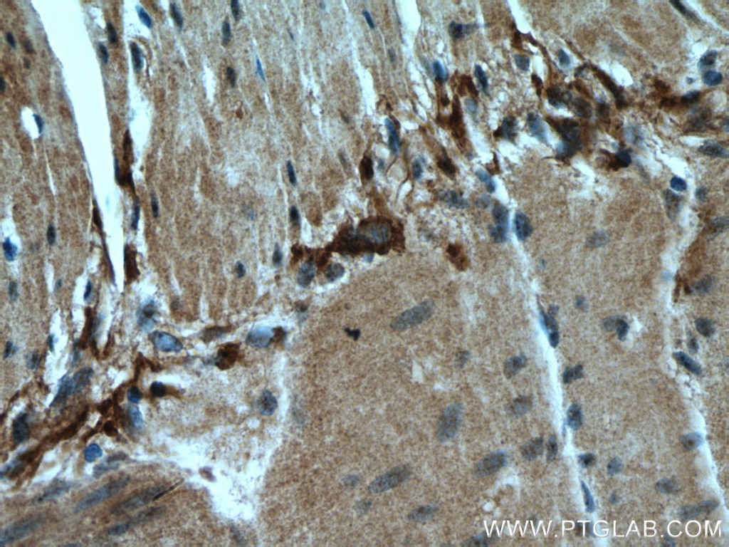 Immunohistochemistry (IHC) staining of human small intestine tissue using MYO6 Polyclonal antibody (26778-1-AP)