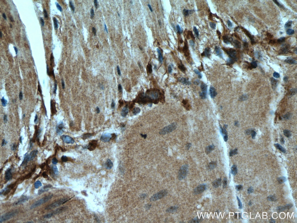 IHC staining of human small intestine using 26778-1-AP