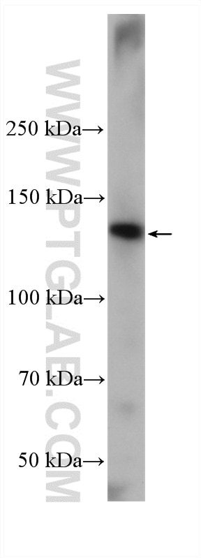 Western Blot (WB) analysis of mouse small intestine tissue using MYO6 Polyclonal antibody (26778-1-AP)