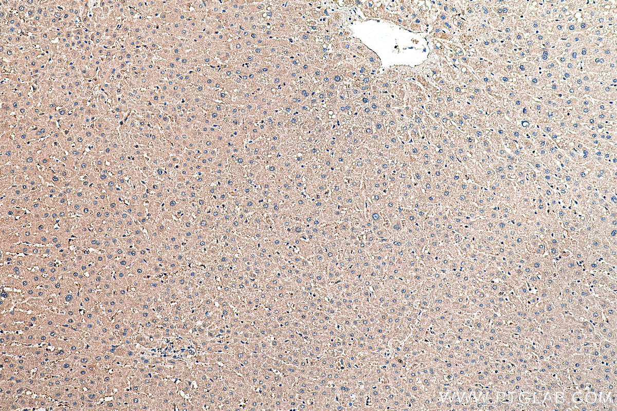 Immunohistochemistry (IHC) staining of human liver tissue using MYO7A Polyclonal antibody (20720-1-AP)