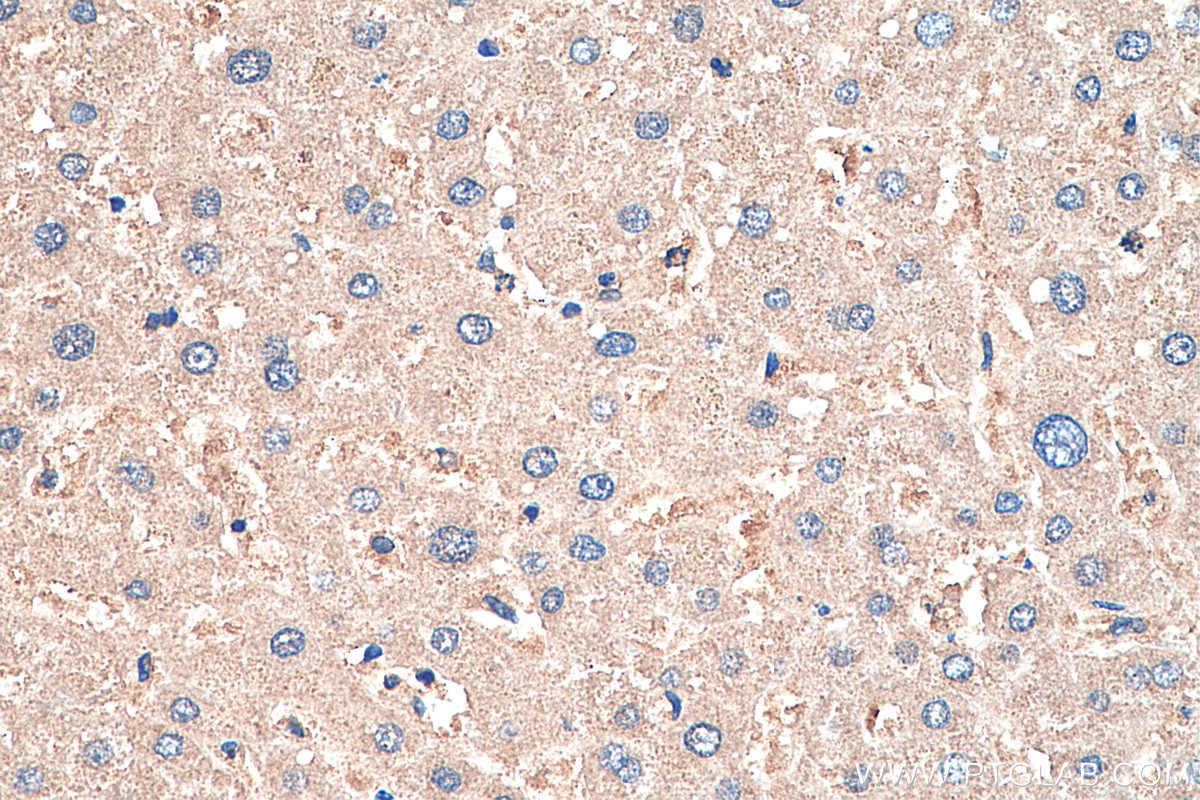 Immunohistochemistry (IHC) staining of human liver tissue using MYO7A Polyclonal antibody (20720-1-AP)