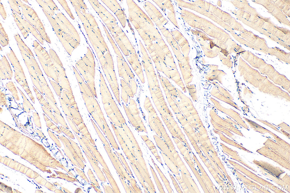 Immunohistochemistry (IHC) staining of mouse skeletal muscle tissue using MYO7A Polyclonal antibody (20720-1-AP)