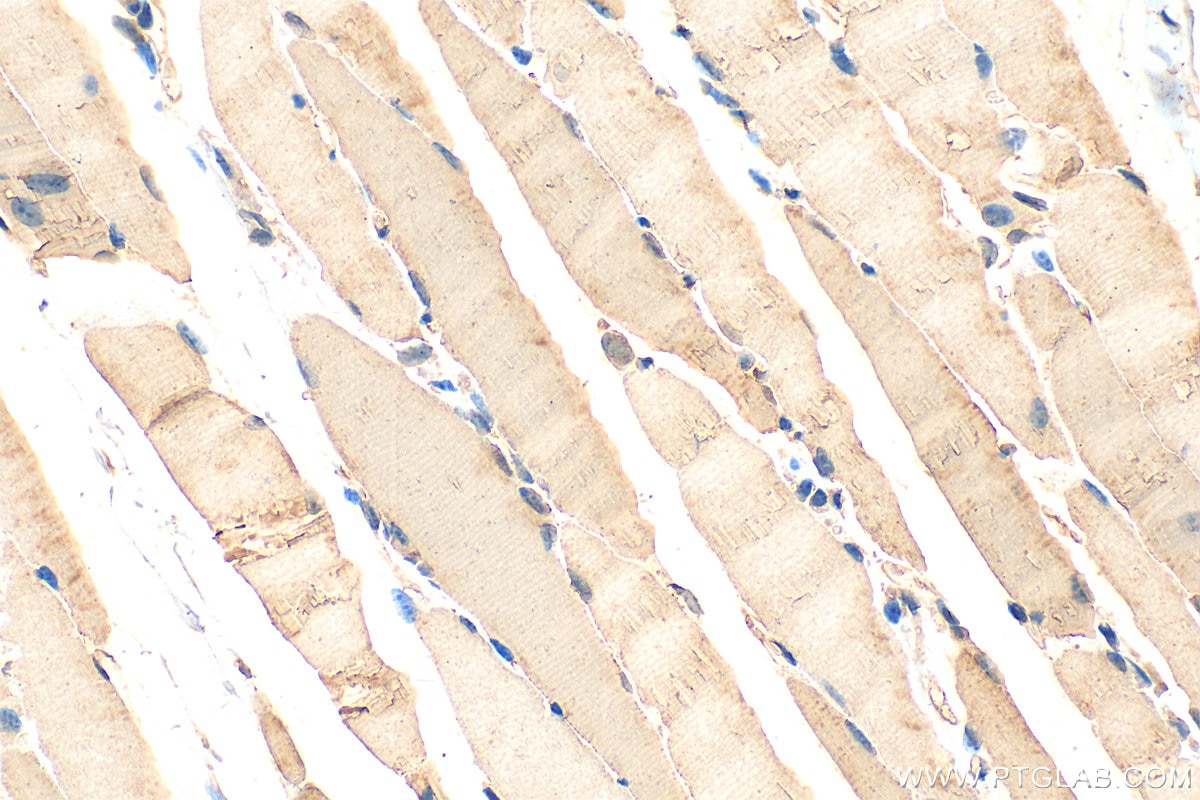 Immunohistochemistry (IHC) staining of mouse skeletal muscle tissue using MYO7A Polyclonal antibody (20720-1-AP)