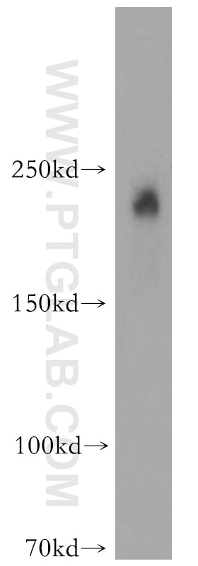 Western Blot (WB) analysis of A431 cells using MYO7A Polyclonal antibody (20720-1-AP)