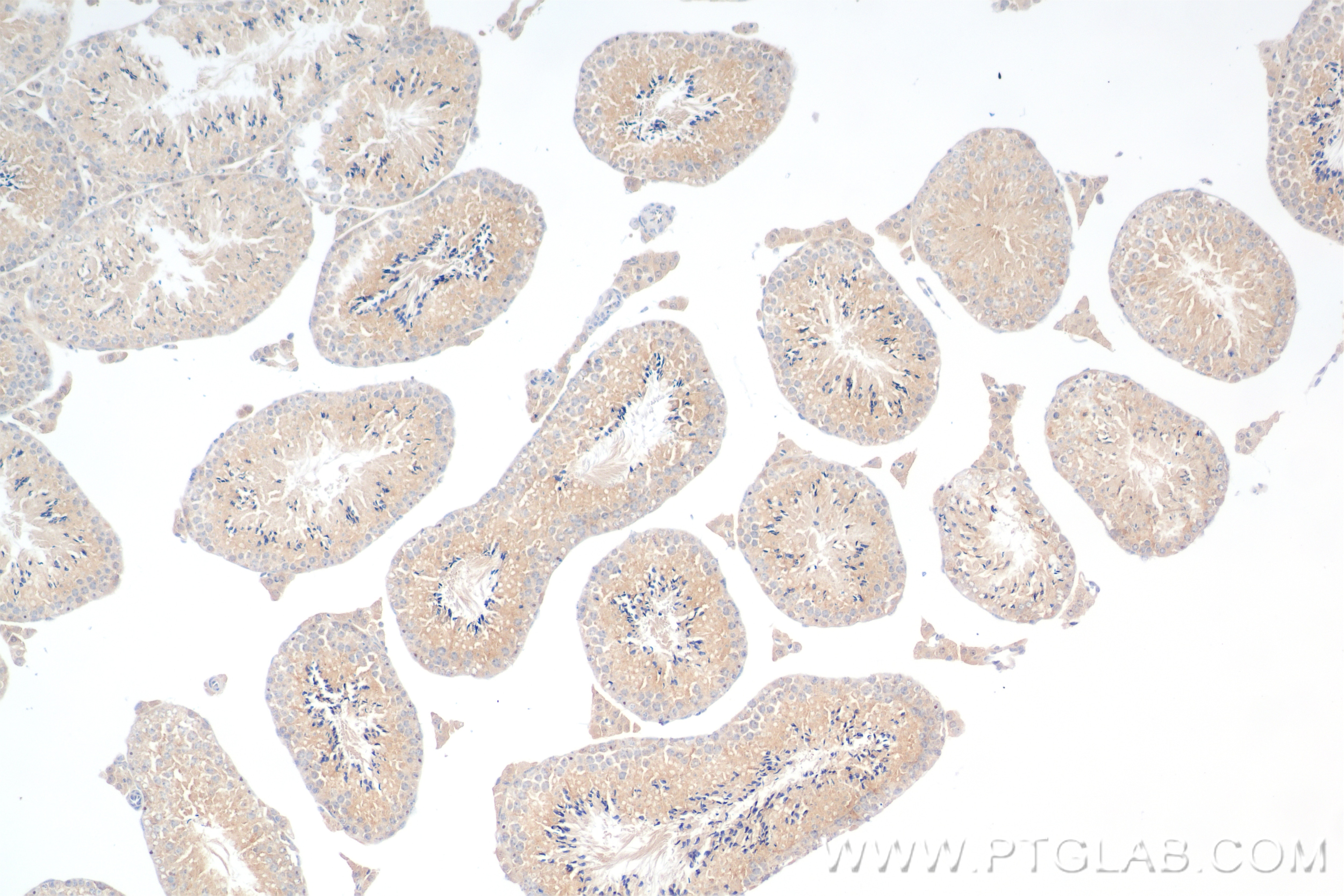 Immunohistochemistry (IHC) staining of mouse testis tissue using MYO7A Recombinant antibody (83807-1-RR)