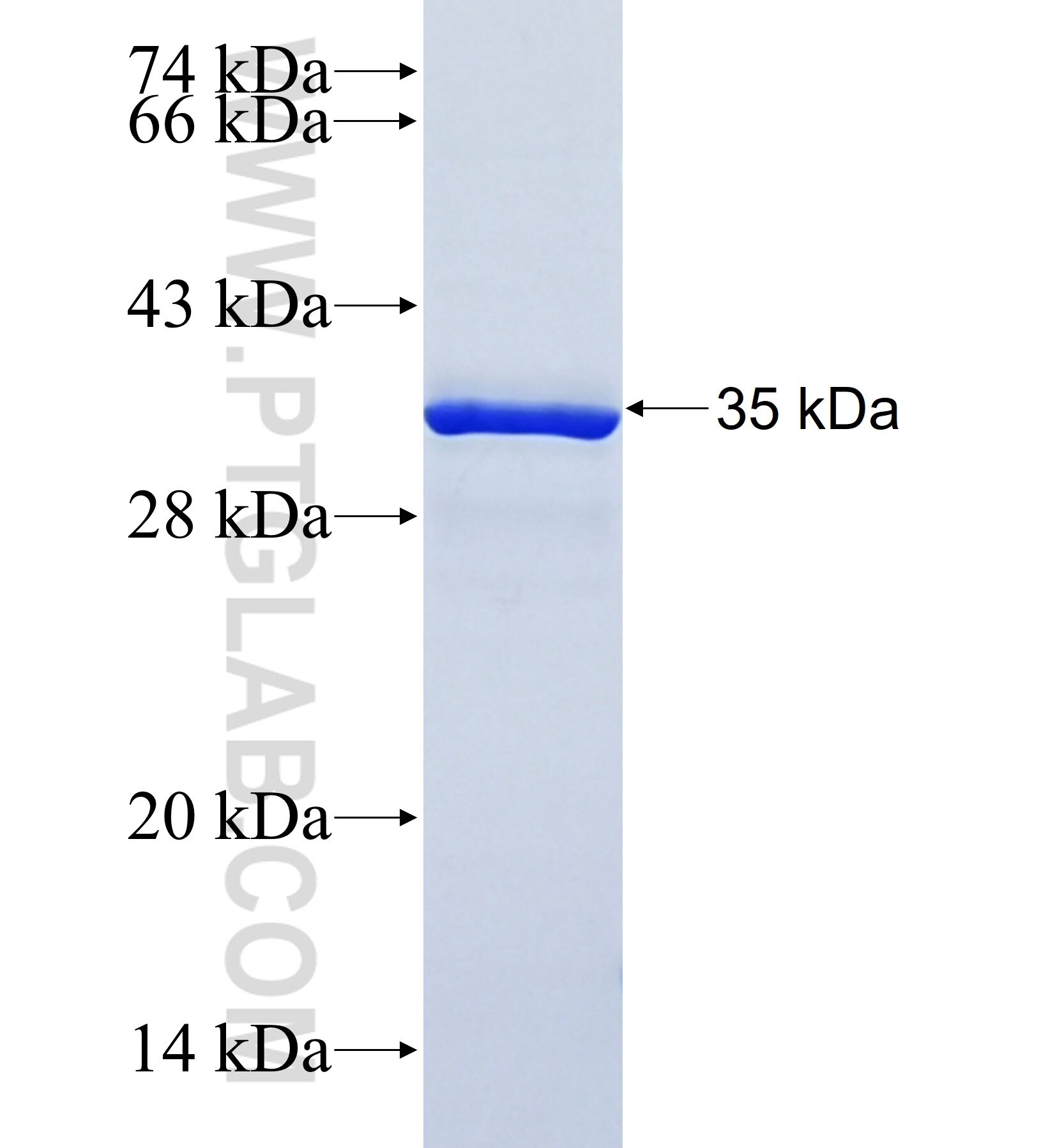 MYO7A fusion protein Ag41975 SDS-PAGE MYO7A fusion protein Ag41975 SDS-PAGE