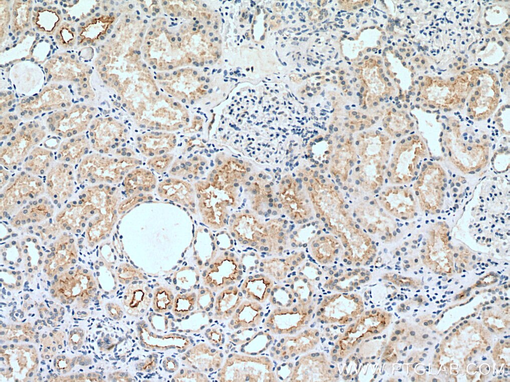 Immunohistochemistry (IHC) staining of human kidney tissue using MYO7B Polyclonal antibody (14467-1-AP)