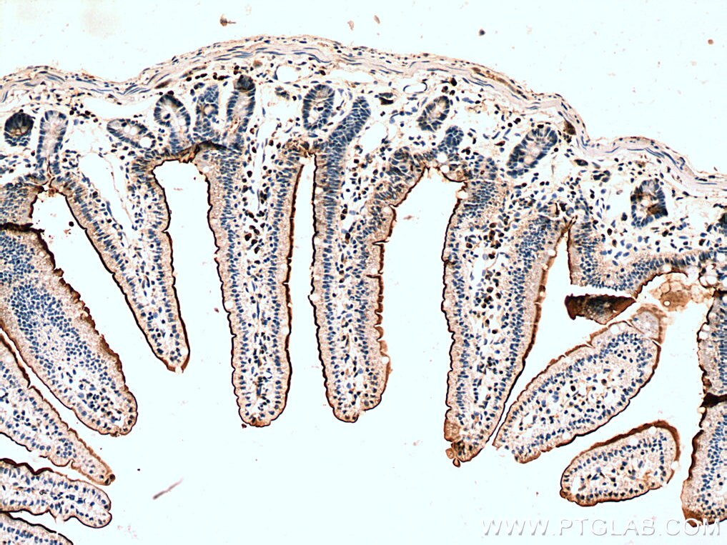 Immunohistochemistry (IHC) staining of mouse small intestine tissue using MYO7B Polyclonal antibody (14467-1-AP)