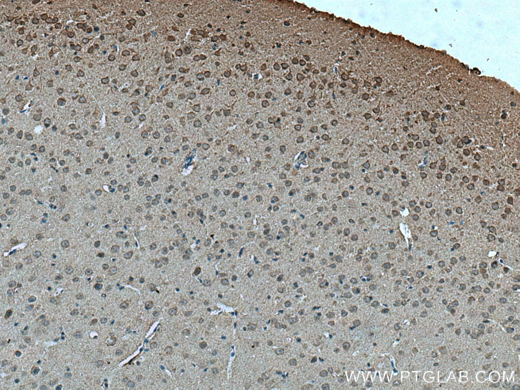 Immunohistochemistry (IHC) staining of mouse brain tissue using MYO9A Polyclonal antibody (26869-1-AP)