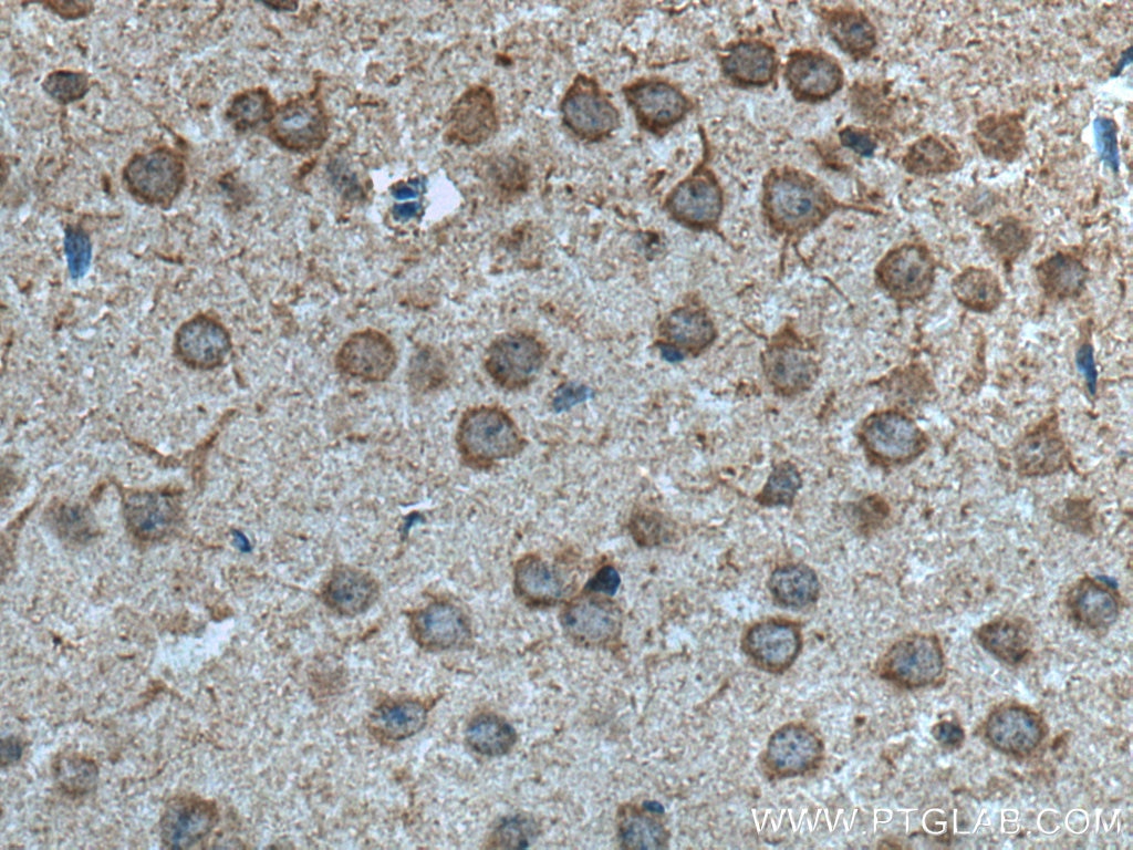 Immunohistochemistry (IHC) staining of mouse brain tissue using MYO9A Polyclonal antibody (26869-1-AP)