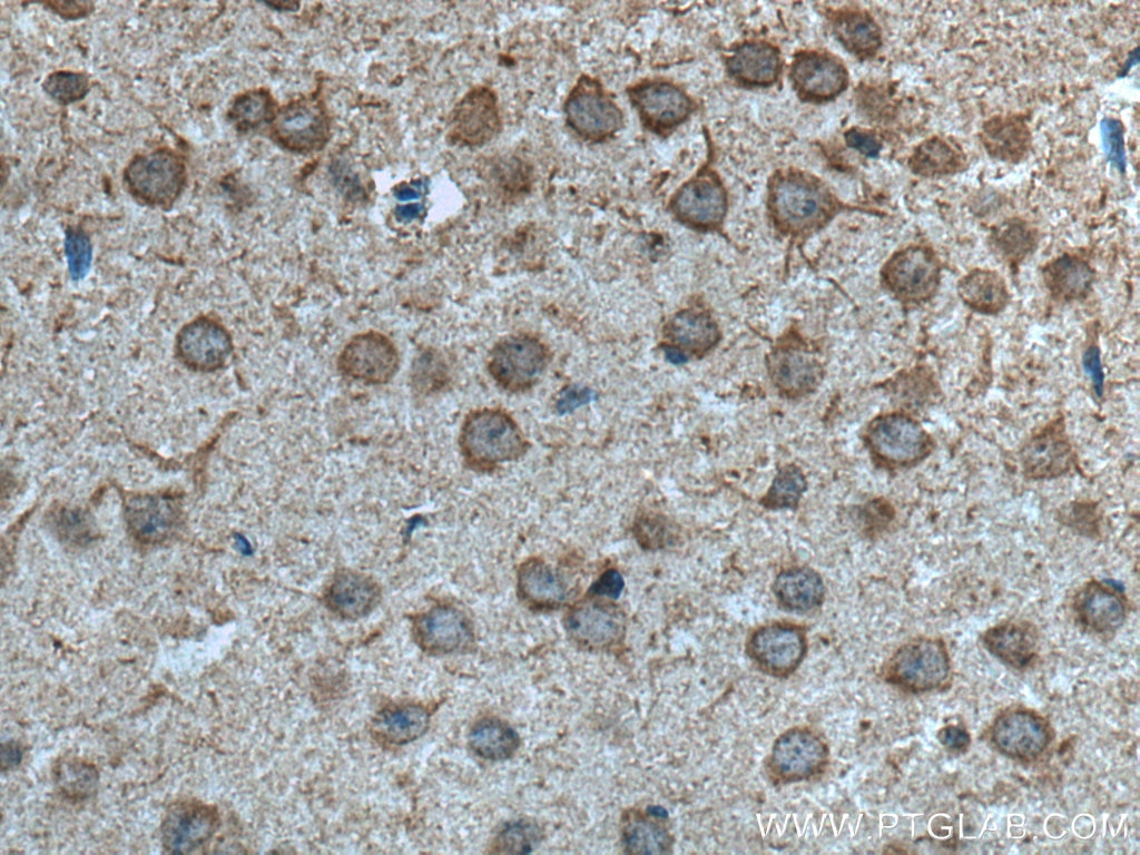 Immunohistochemistry (IHC) staining of mouse brain tissue using MYO9A Polyclonal antibody (26869-1-AP)