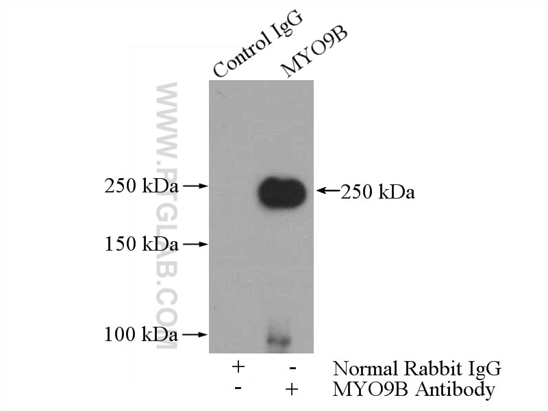Immunoprecipitation (IP) experiment of HepG2 cells using MYO9B Polyclonal antibody (12432-1-AP)
