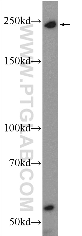 Western Blot (WB) analysis of mouse thymus tissue using MYO9B Polyclonal antibody (12432-1-AP)