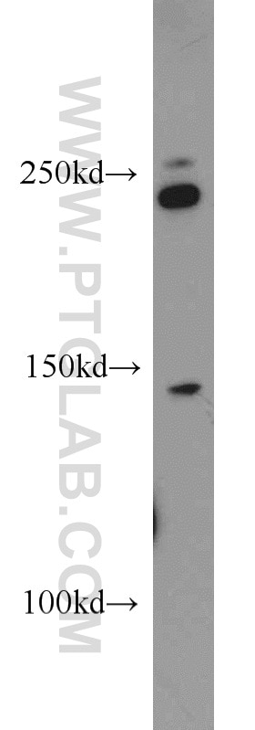 Western Blot (WB) analysis of Jurkat cells using MYO9B Polyclonal antibody (12432-1-AP)