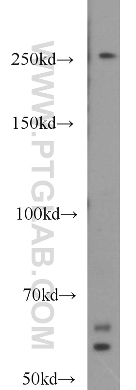 WB analysis of HL-60 using 12432-1-AP