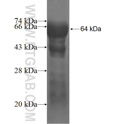 MYO9B fusion protein Ag3108 SDS-PAGE
