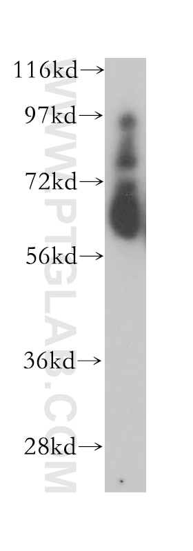 Western Blot (WB) analysis of human heart tissue using Myocilin Polyclonal antibody (14238-1-AP)