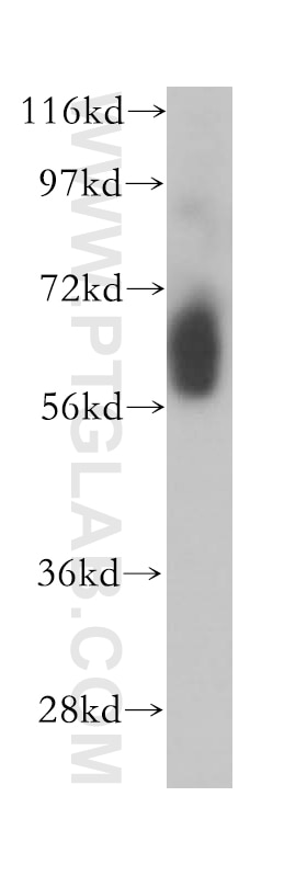 Western Blot (WB) analysis of mouse skeletal muscle tissue using Myocilin Polyclonal antibody (14238-1-AP)