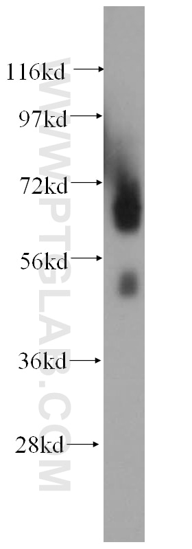Western Blot (WB) analysis of human stomach tissue using Myocilin Polyclonal antibody (14238-1-AP)