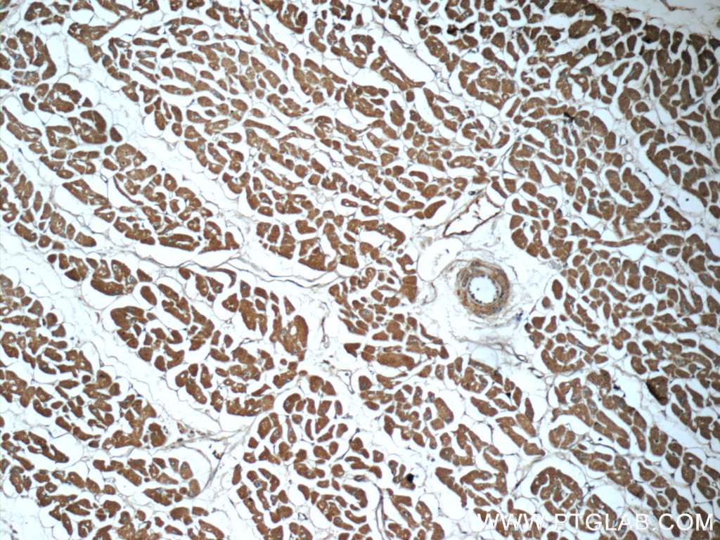 Immunohistochemistry (IHC) staining of human heart tissue using Myocilin Monoclonal antibody (60357-1-Ig)