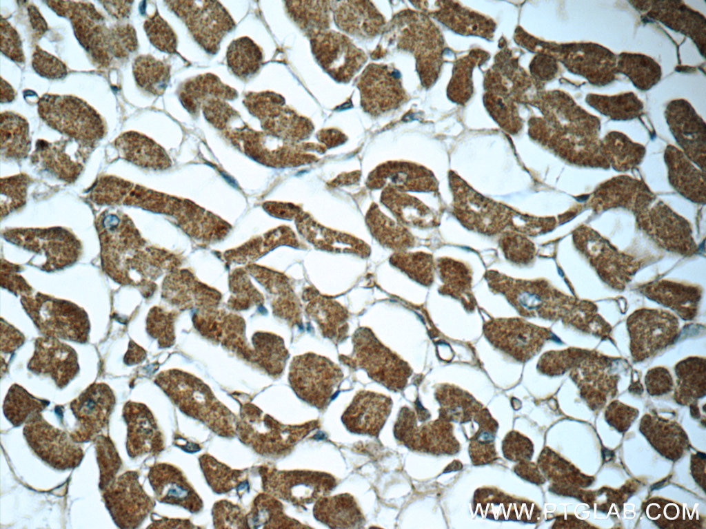 Immunohistochemistry (IHC) staining of human heart tissue using Myocilin Monoclonal antibody (60357-1-Ig)