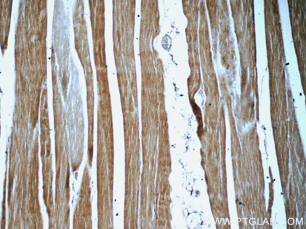 Immunohistochemistry (IHC) staining of human skeletal muscle tissue using Myocilin Monoclonal antibody (60357-1-Ig)