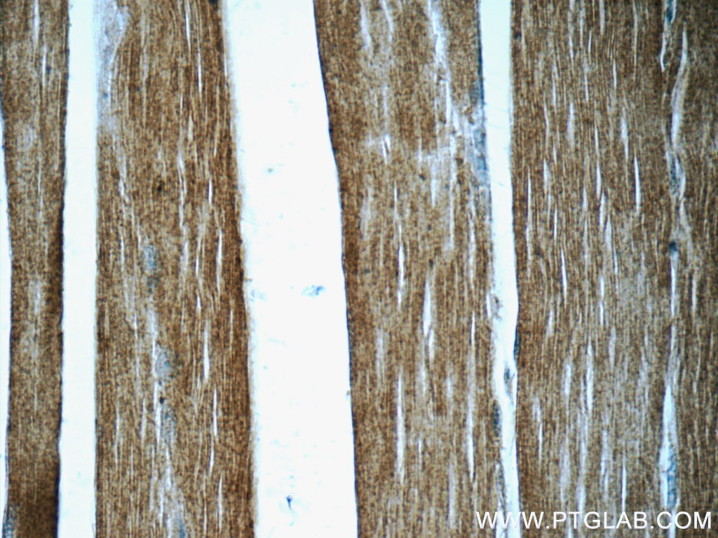 Immunohistochemistry (IHC) staining of human skeletal muscle tissue using Myocilin Monoclonal antibody (60357-1-Ig)