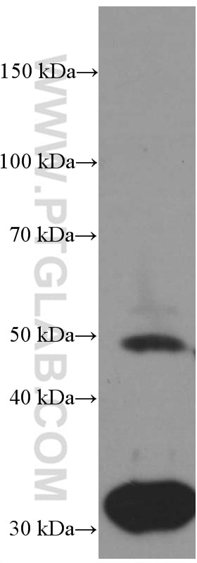 Western Blot (WB) analysis of human skeletal muscle tissue using Myocilin Monoclonal antibody (60357-1-Ig)