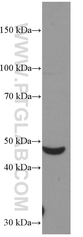 Western Blot (WB) analysis of human spleen tissue using Myocilin Monoclonal antibody (60357-1-Ig)