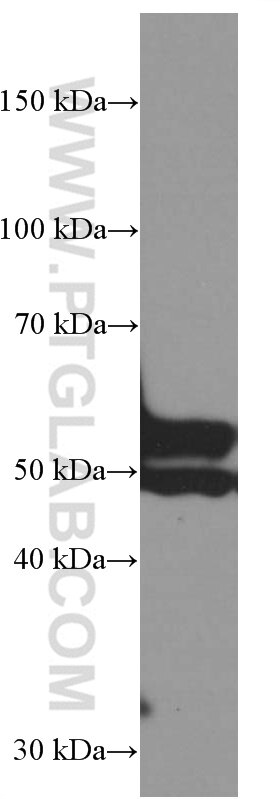 Western Blot (WB) analysis of pig heart tissue using Myocilin Monoclonal antibody (60357-1-Ig)