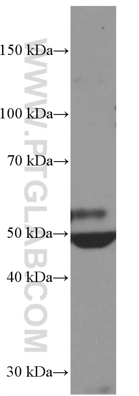 Western Blot (WB) analysis of rat heart tissue using Myocilin Monoclonal antibody (60357-1-Ig)