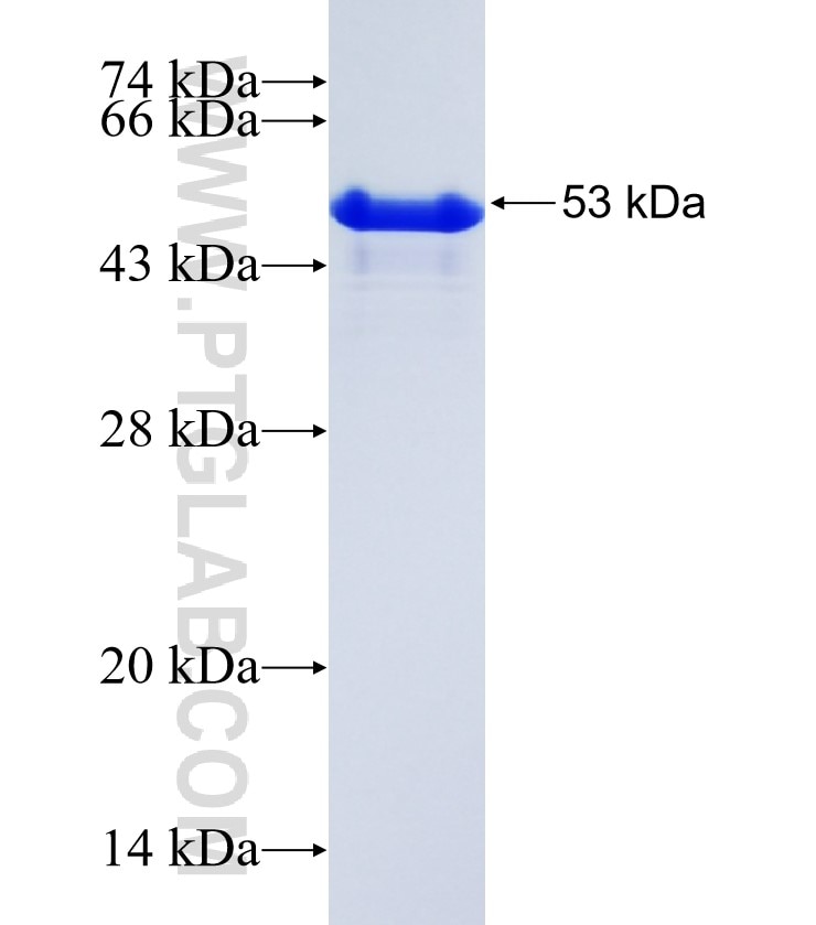 MYOCD fusion protein Ag35153 SDS-PAGE MYOCD fusion protein Ag35153 SDS-PAGE