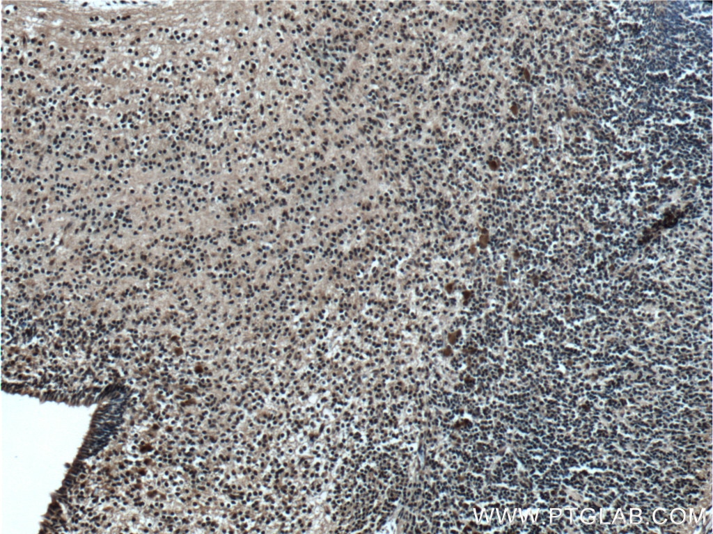 IHC staining of mouse embryo using 18943-1-AP