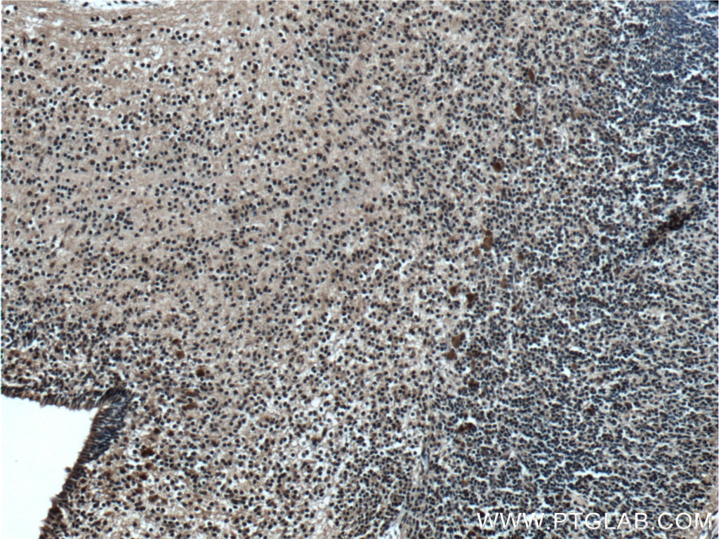 Immunohistochemistry (IHC) staining of mouse embryo tissue using MYOD1 Polyclonal antibody (18943-1-AP)