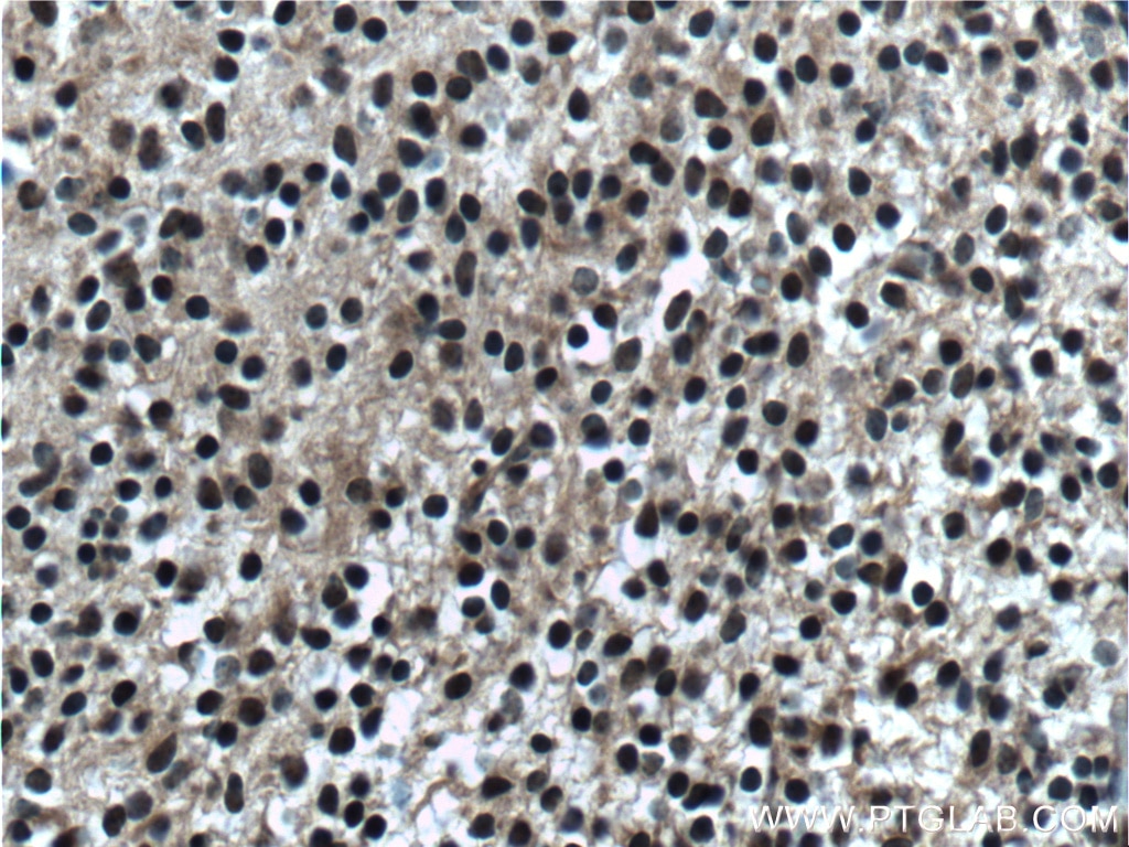 Immunohistochemistry (IHC) staining of mouse embryo tissue using MYOD1 Polyclonal antibody (18943-1-AP)