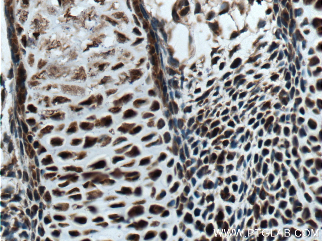 Immunohistochemistry (IHC) staining of mouse embryo tissue using MYOD1 Polyclonal antibody (18943-1-AP)