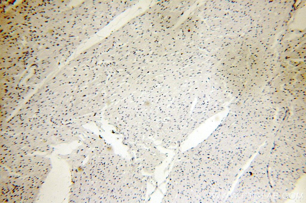 MYOD1