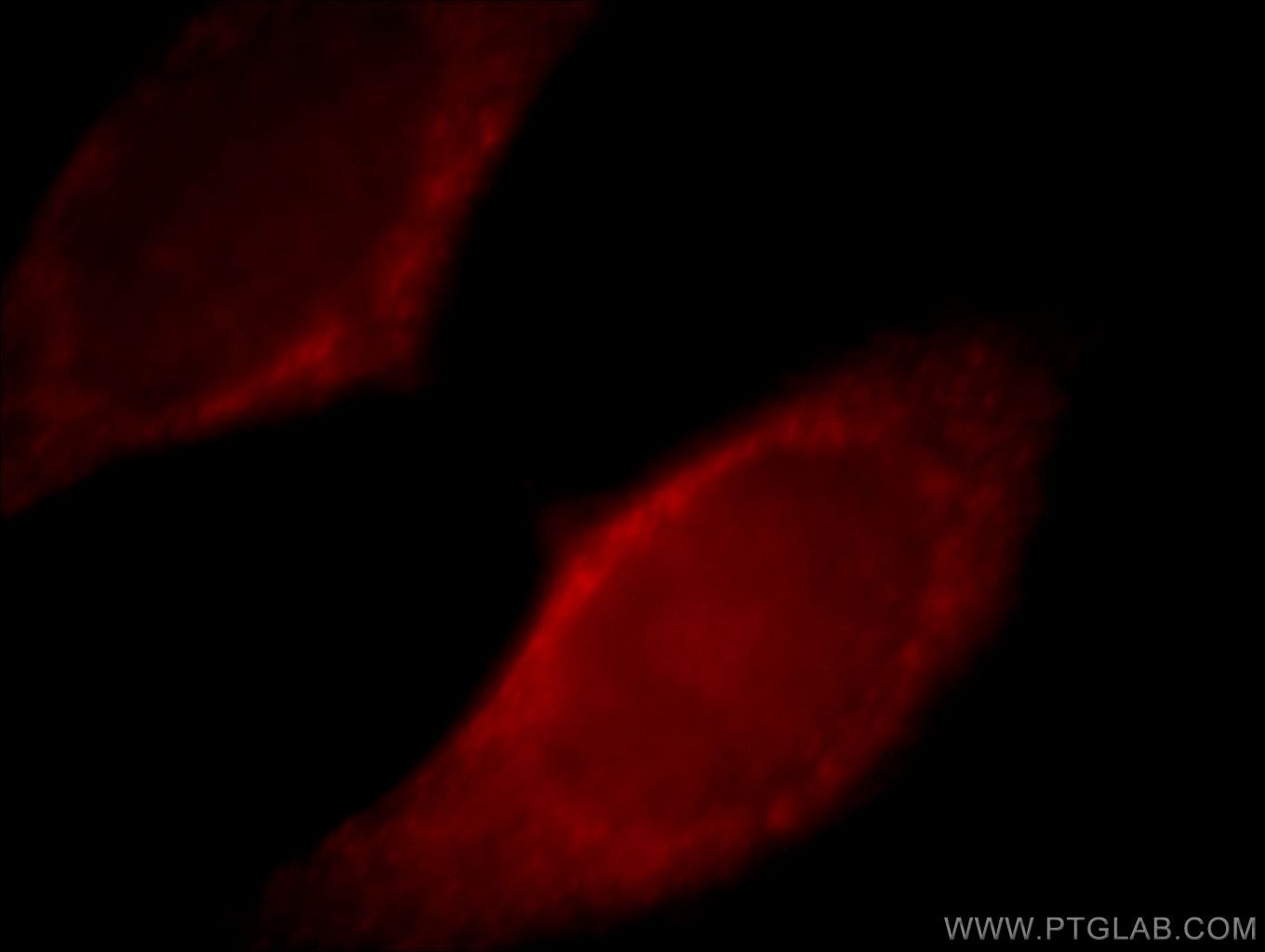 Immunofluorescence (IF) / fluorescent staining of HeLa cells using Myoferlin Polyclonal antibody (19548-1-AP)